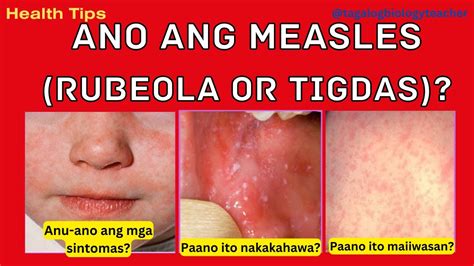 Diagnosis in Tagalog.